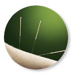 Acupuncture