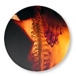 Chiropractic